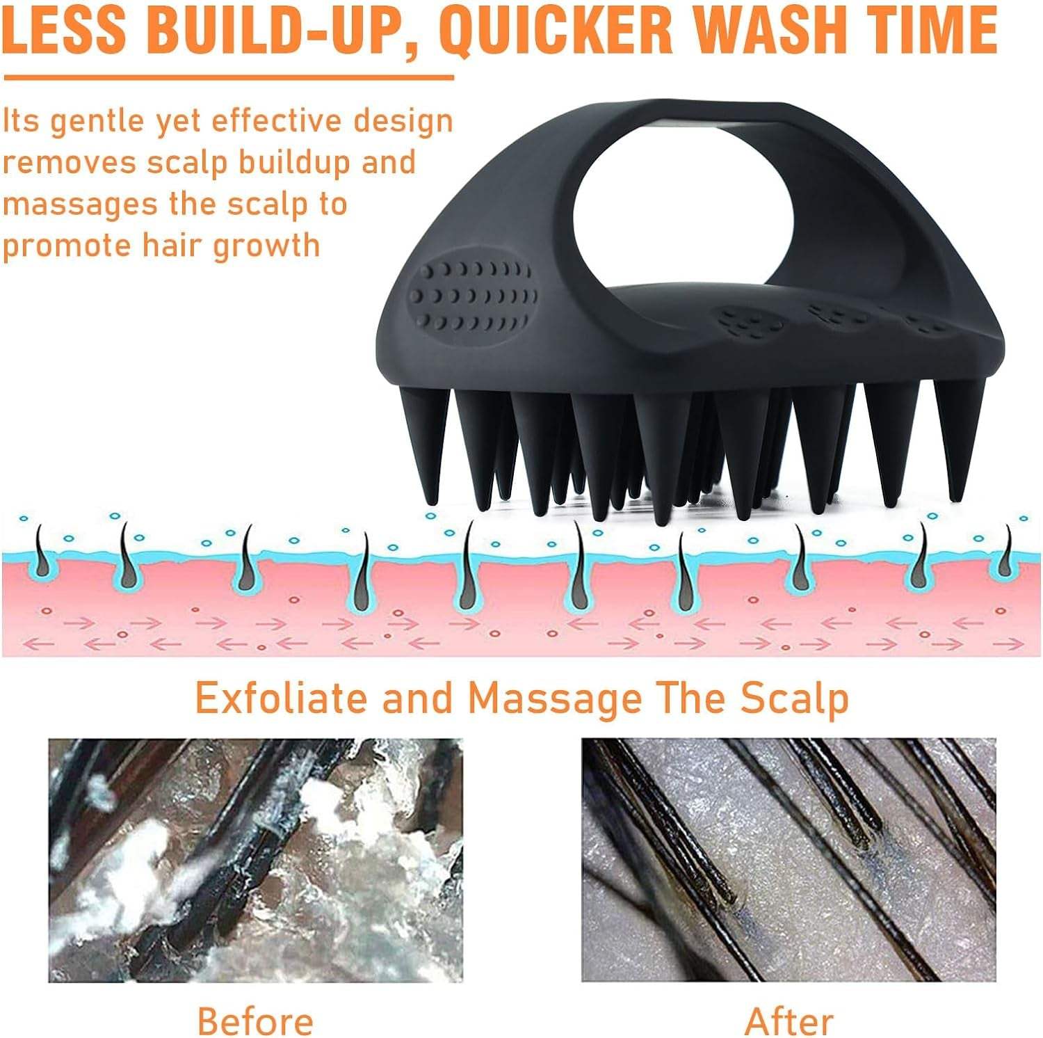 Scalp Massager Shampoo Brush for Men, Women, Boys, and Girls, Scalp ScHELP OUT YOUR HEAD: Want to keep your scalp happy and healthy? Check out our gentle scalp exfoliator brush designed for men. It's perfect for even the most sensitive, Bigger Coverage Shorter Washing Time, Hair Brush